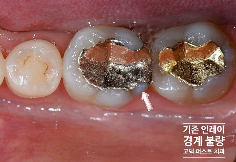 치료 전 상태 확인