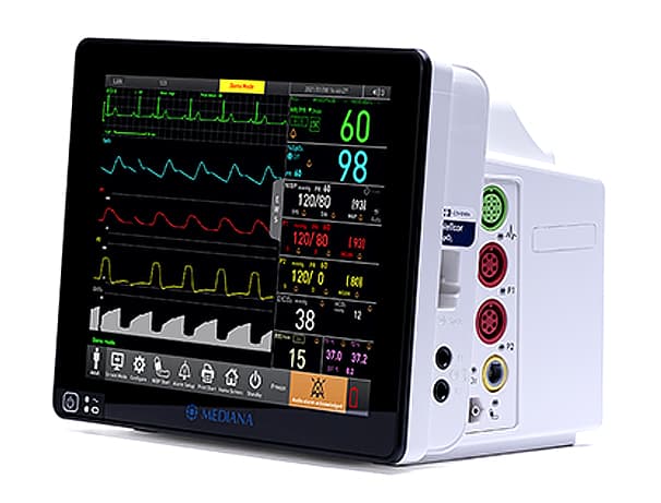 환자 모니터링 장비